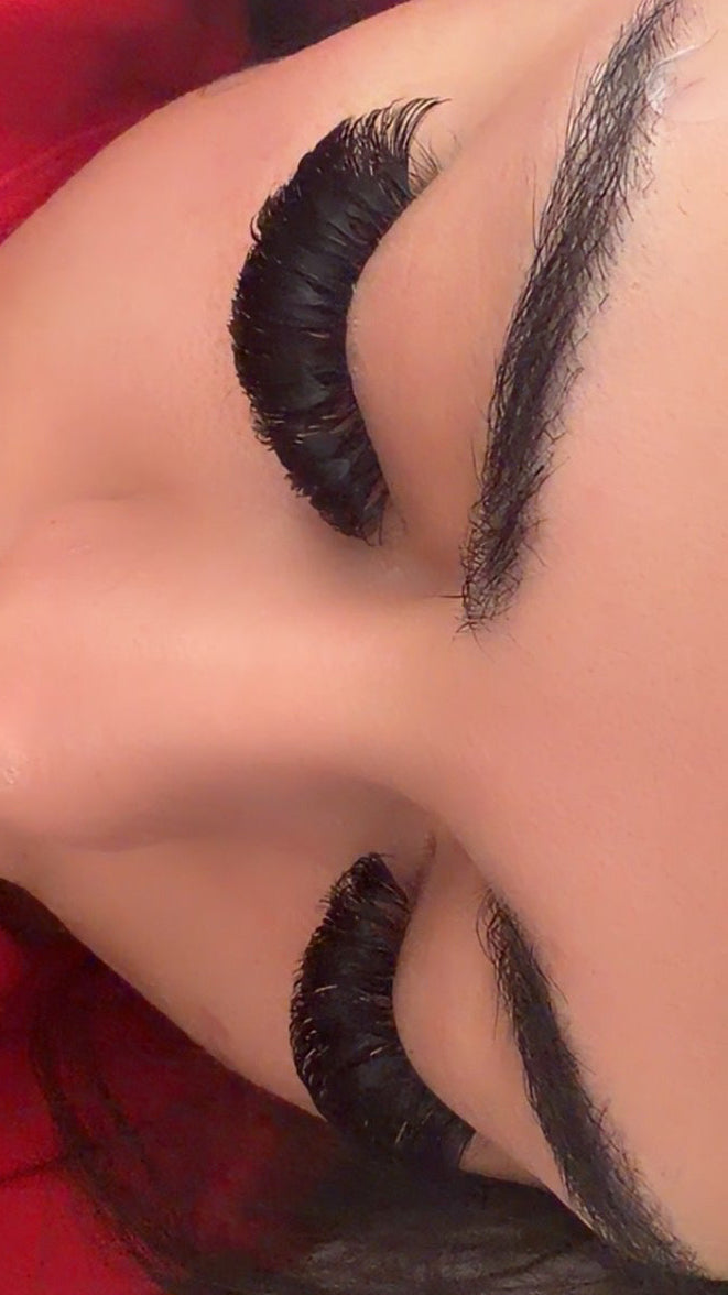 2 Week Retention Using OG Adhesive 